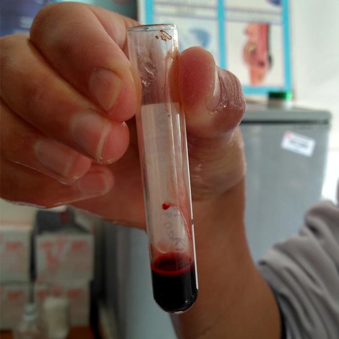 there are so many infections spreading...